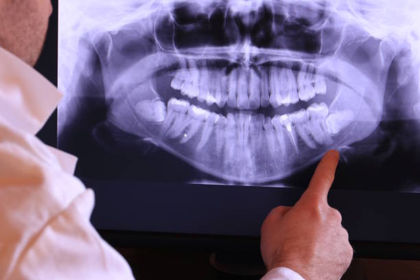 Best Emergency Treatment for Toothache in Anadarko, OK
