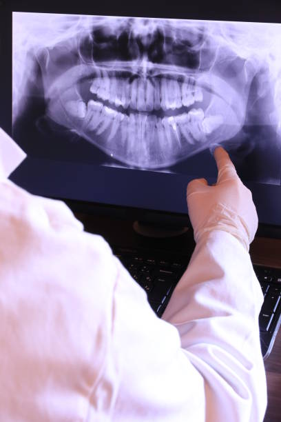 Best Emergency Root Canal Treatment in Anadarko, OK