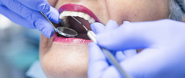 Best Emergency Broken Tooth Repair in Anadarko, OK